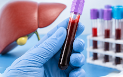 Hepatograma